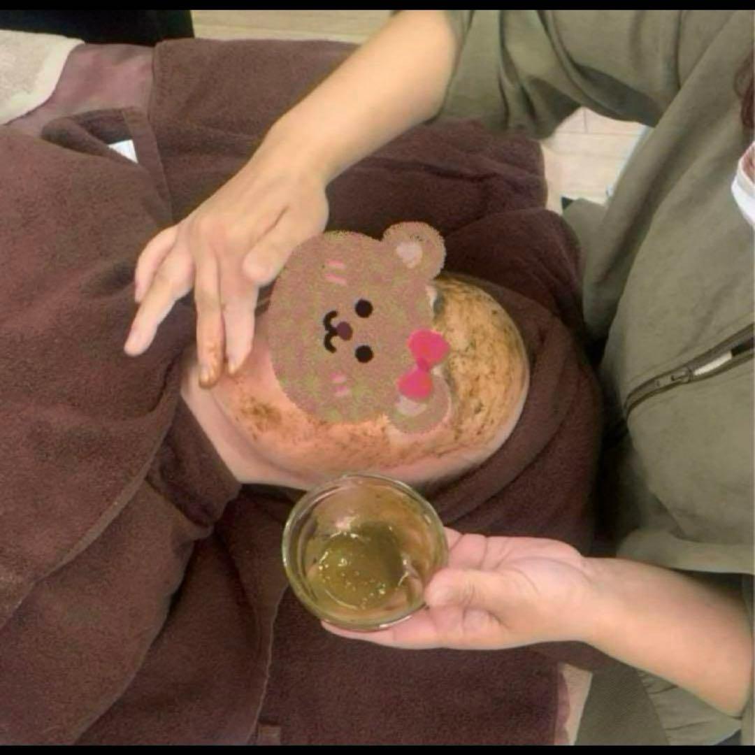 ハーブピーリング剥離無し　10回分　（11月11日から2月20日の間発送停止)