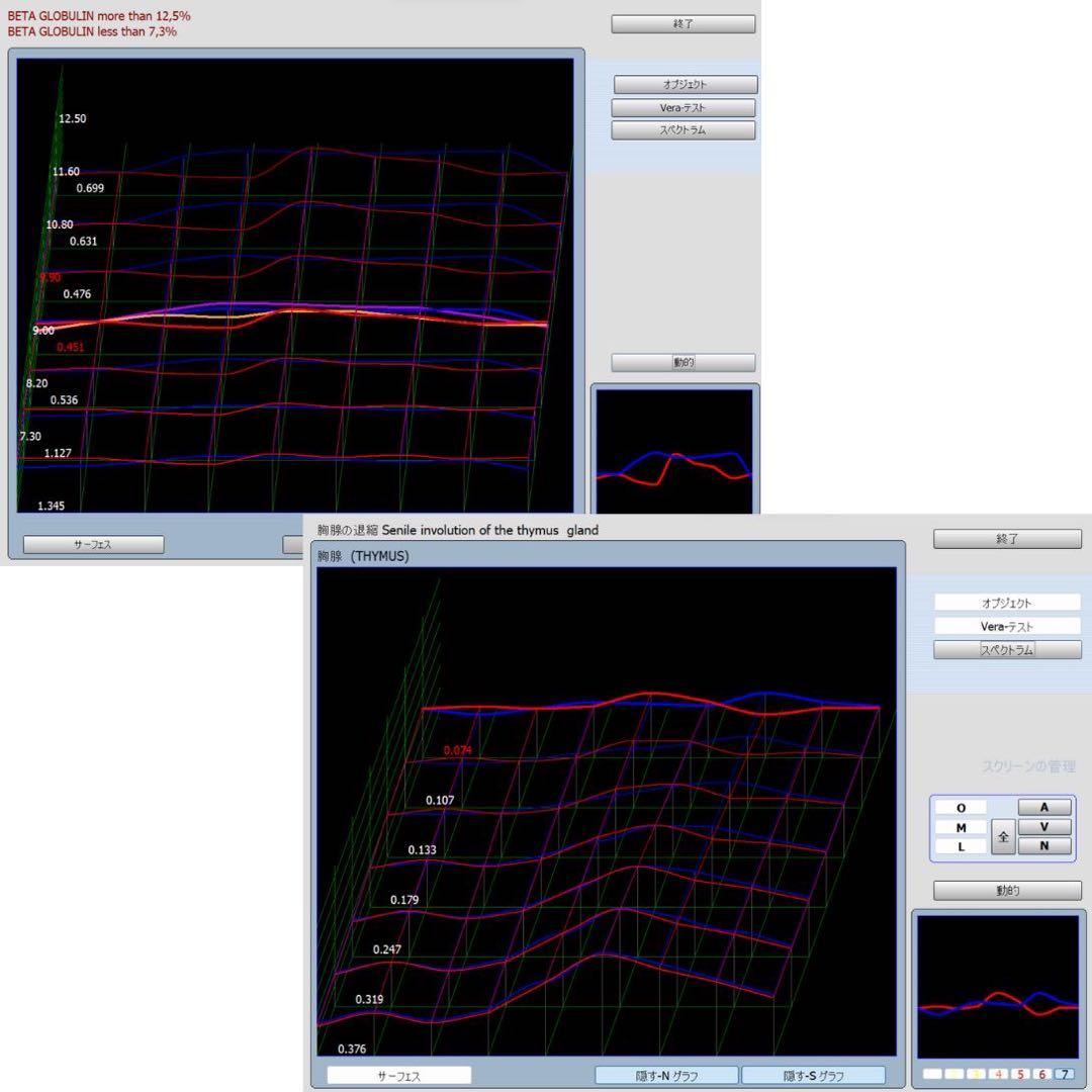 【1年保証】PC付　バイオレゾナンス　波動測定器　波動水　ニュースキャン　サプリ