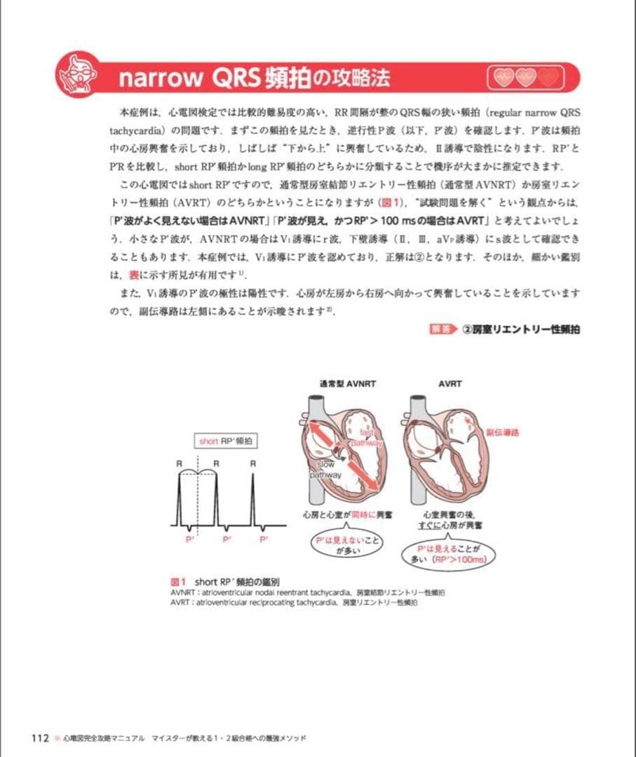 【裁断済】心電図 完全攻略マニュアル & 7日間ブースト