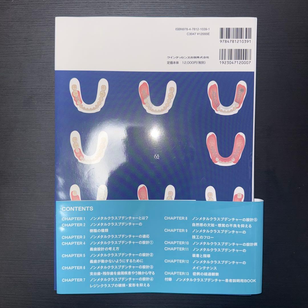 ノンメタルクラスプデンチャー