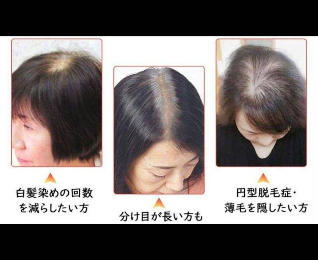 人毛100％前髪付き部分ウィッグ瞬間カバーＩ型つむじ地肌総手植えヘアピース✨特注
