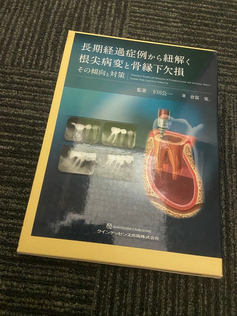 長期経過症例から紐解く根尖病変と骨縁下欠損 その傾向と対策
