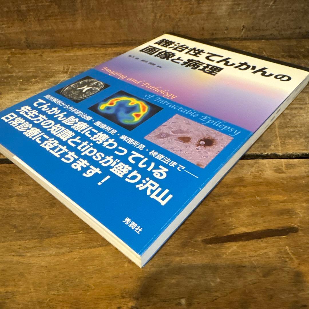 難治性てんかんの画像と病理