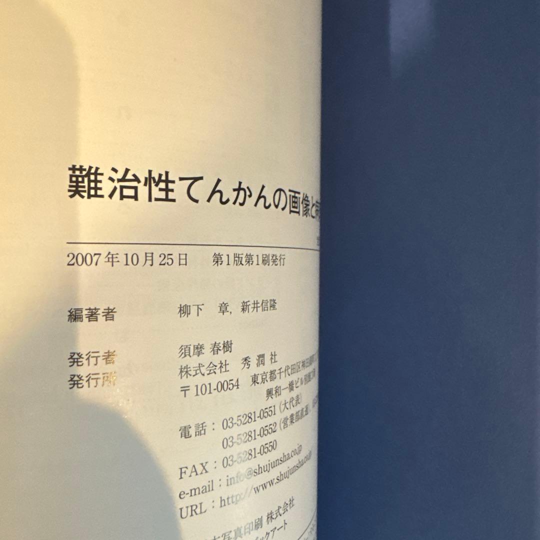 難治性てんかんの画像と病理