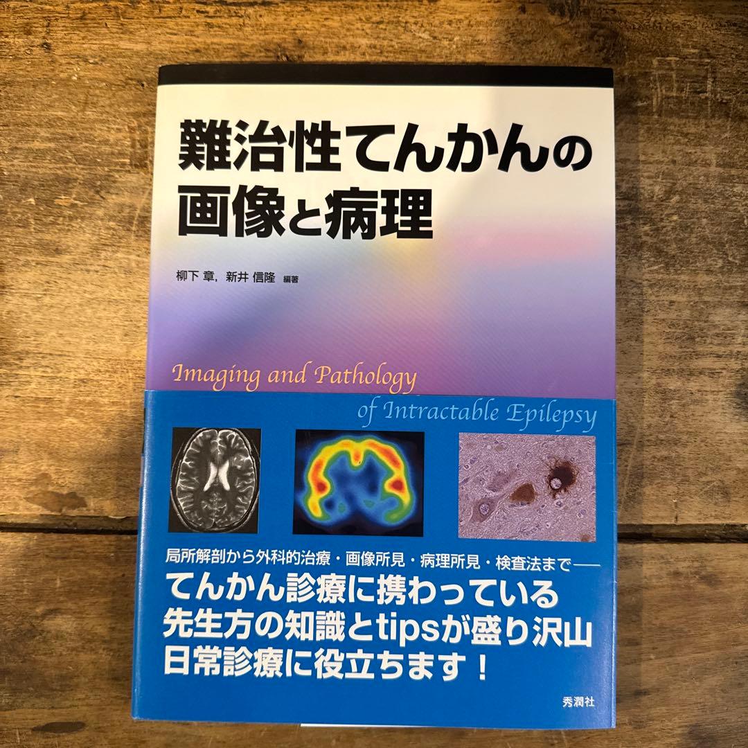 難治性てんかんの画像と病理