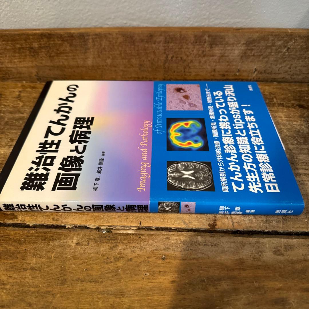 難治性てんかんの画像と病理