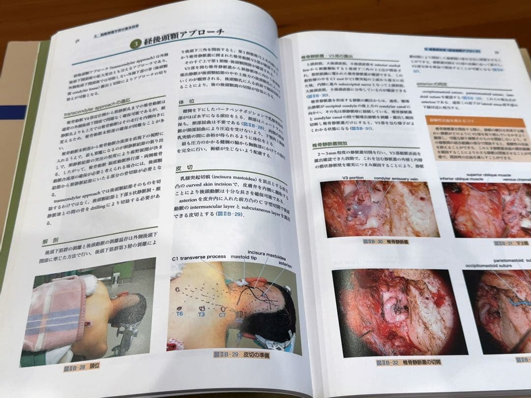 脳動脈瘤手術　基本技術と応用