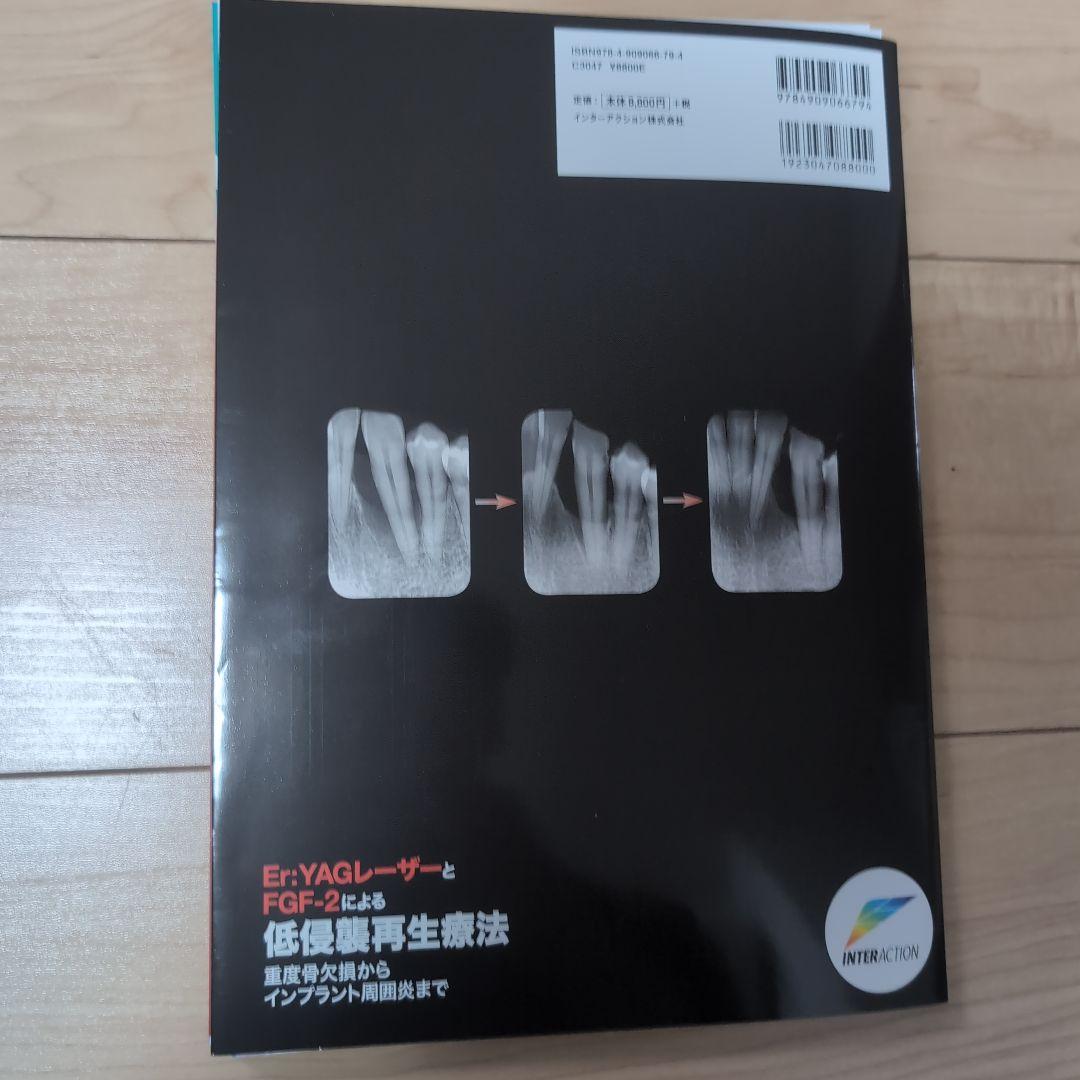 ⚠裁断済　Er: YAGレーザーとFGF-2による低侵襲再生療法 : 重度…　☆
