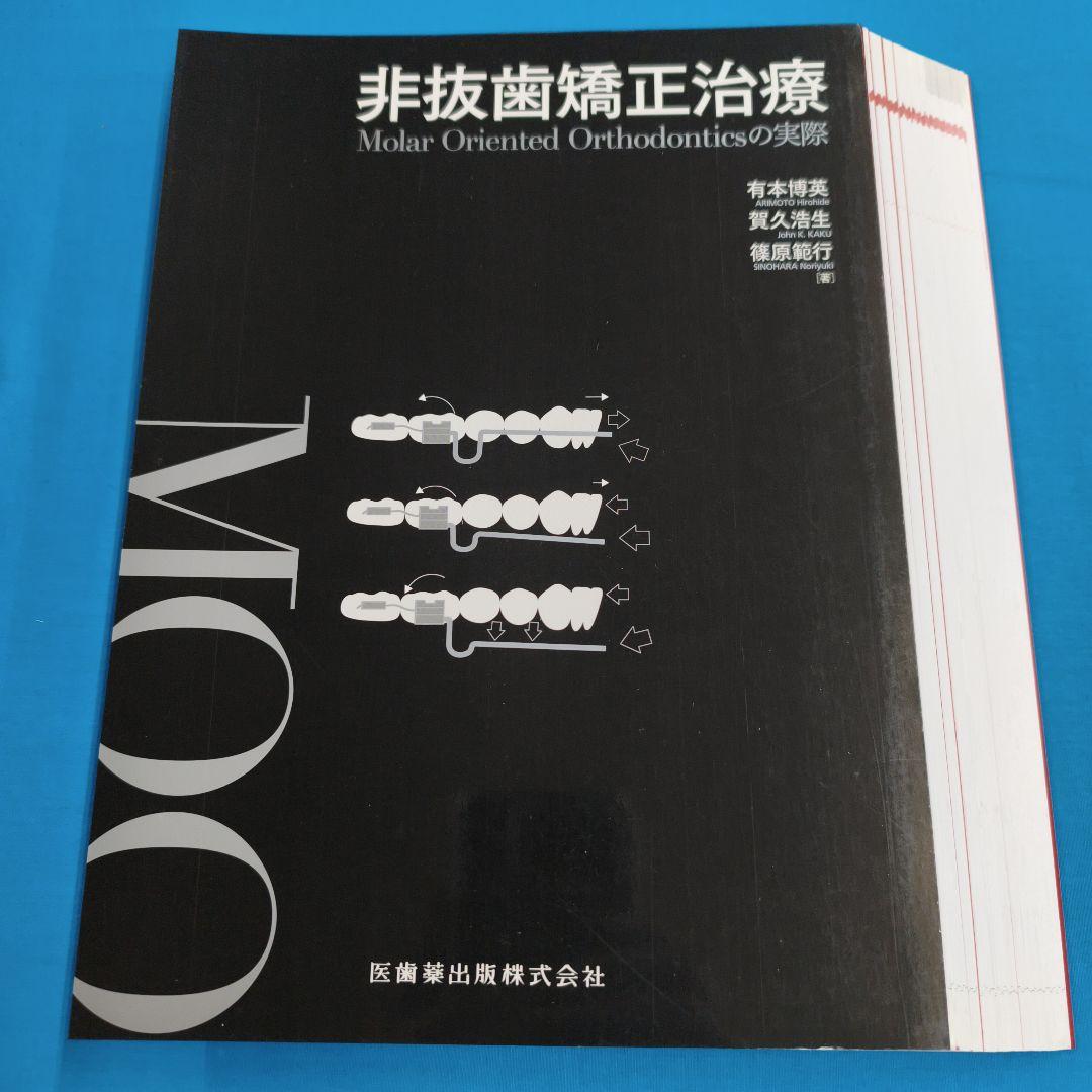 ●裁断済 非抜歯矯正治療 Molar Oriented Orthodontics