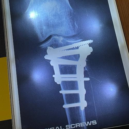 洋書【解剖学・骨格がわかる】レントゲン遊び　AMAZING X-RAYS　人体