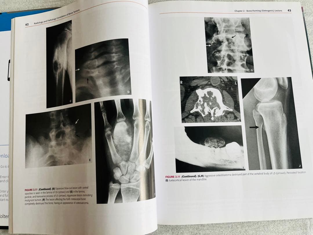 健康・医学 Radiology and Pathology Correlation