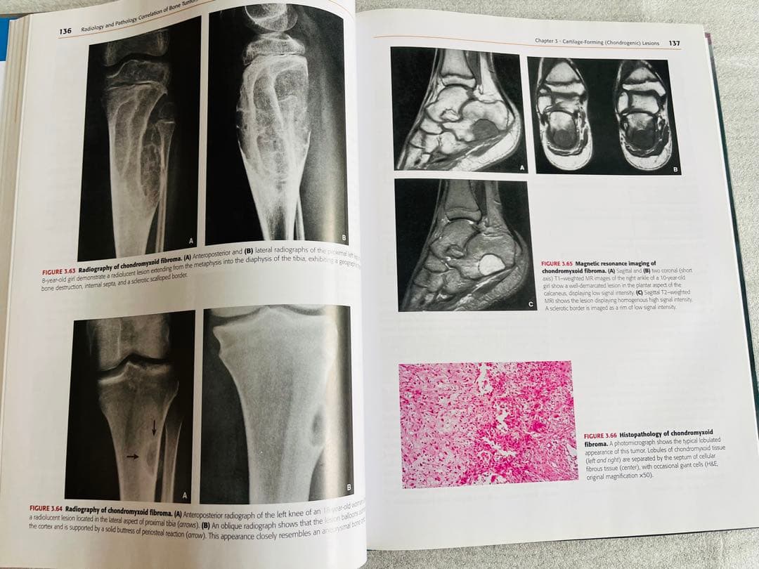 健康・医学 Radiology and Pathology Correlation