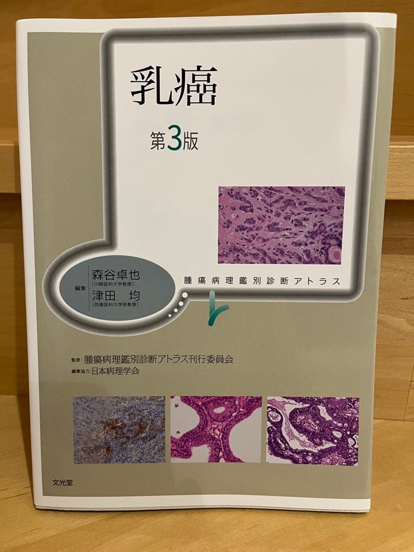 乳癌 第3版