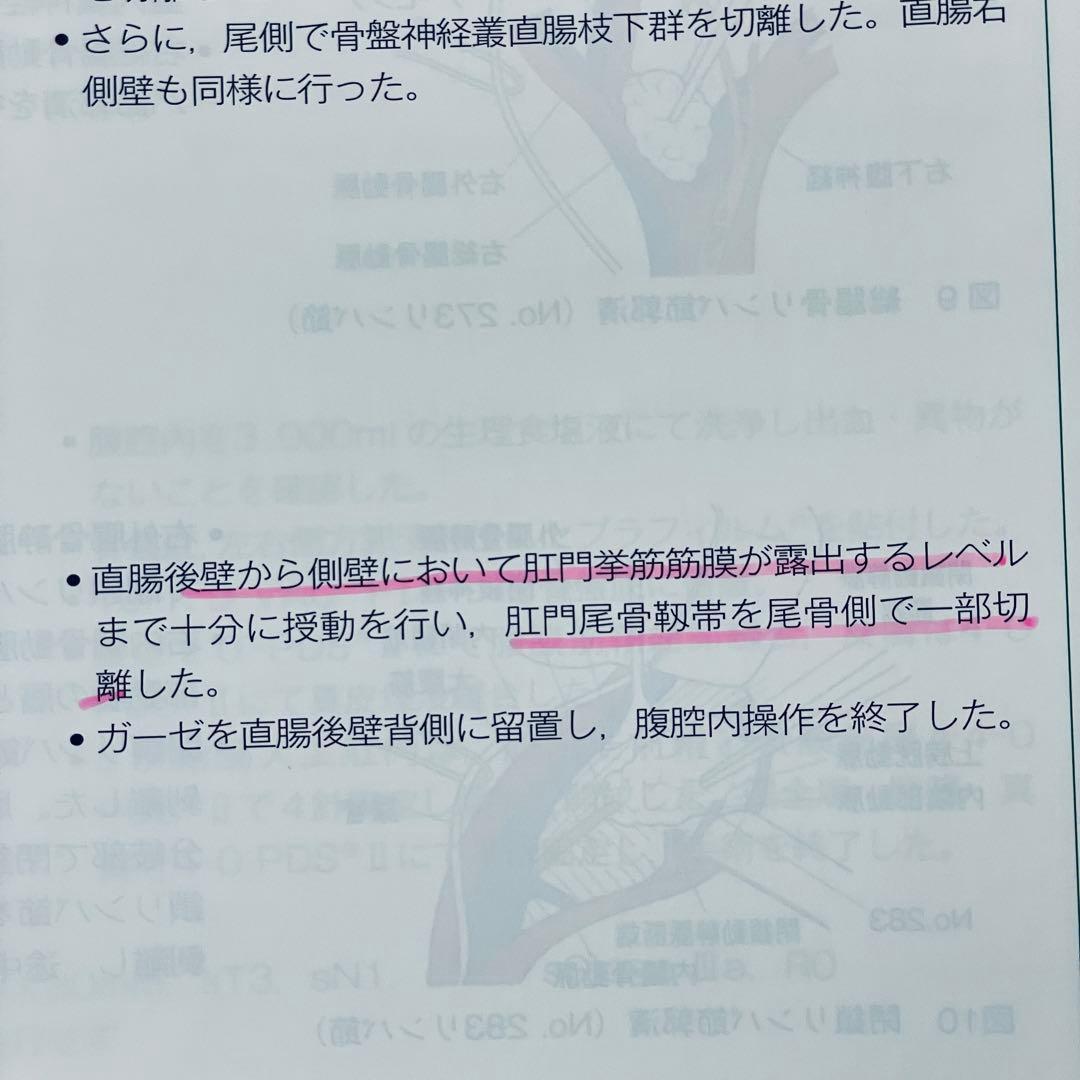 消化器外科　手術記録の書き方 Vol.37 No.5 2014年4月号