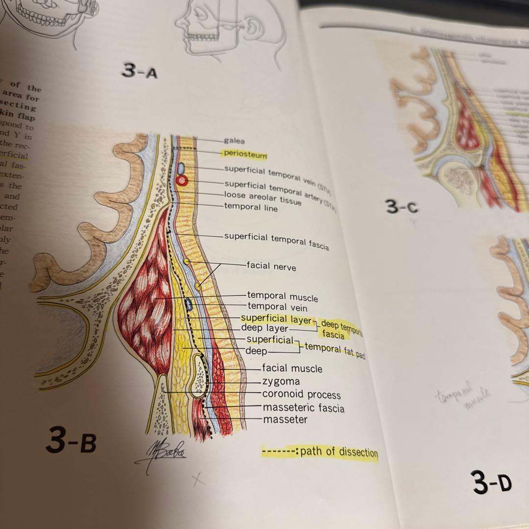 健康・医学 Surgical anatomy of the skull base