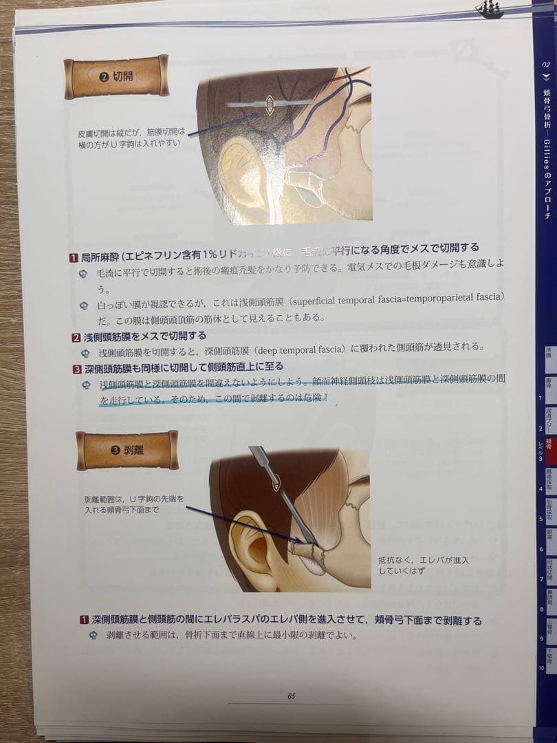 裁断済　コンパス顔面骨骨折の治療 : Clinical Operation