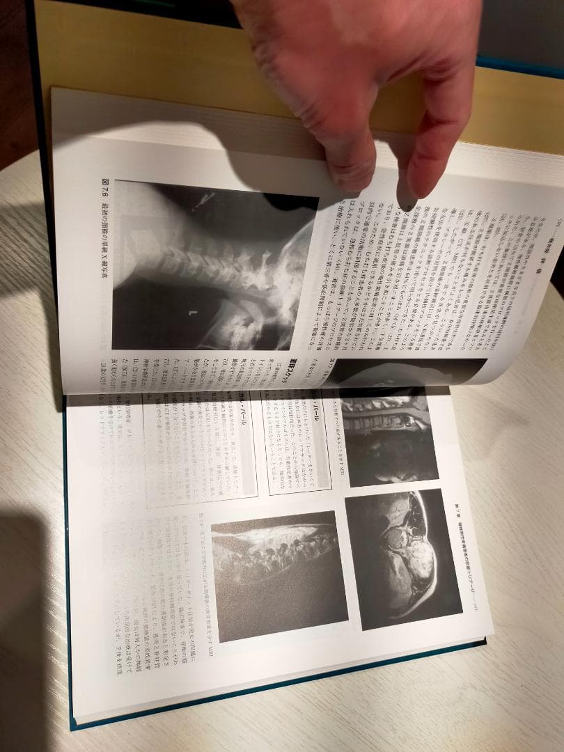 美品　脊椎のリハビリテーション　上下巻セット