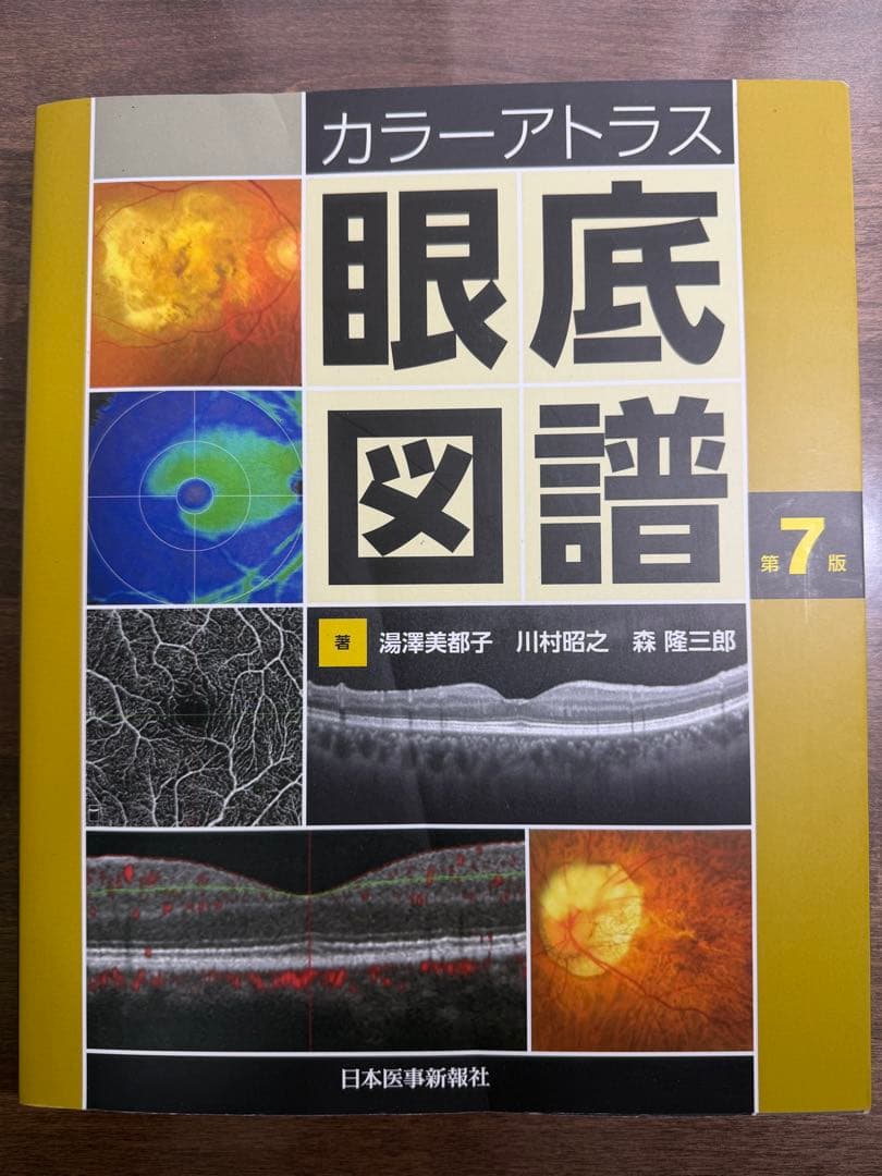 カラーアトラス 眼底図譜 第7版