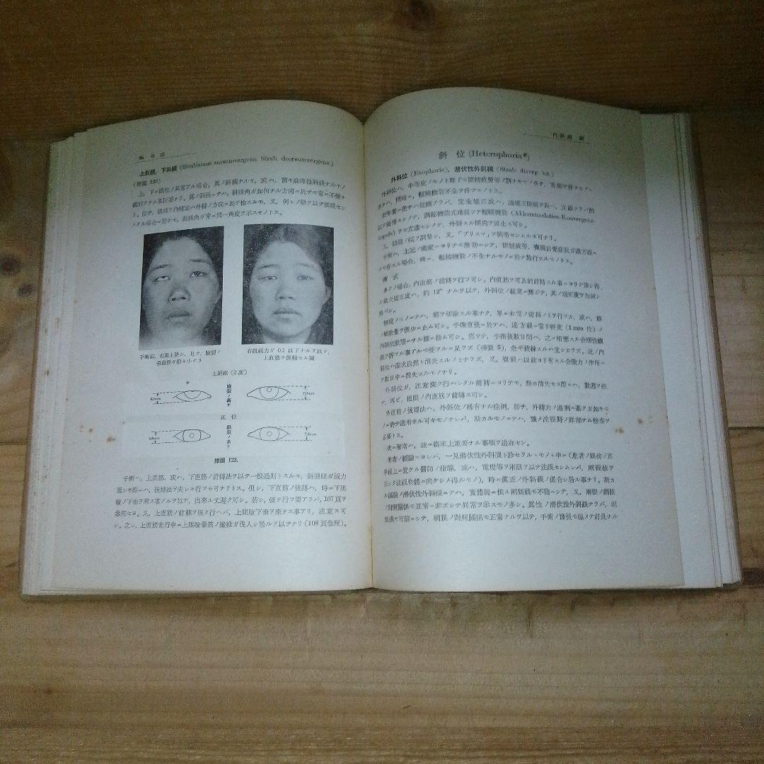 図解　眼科手術学　第３集　絶版　医学書