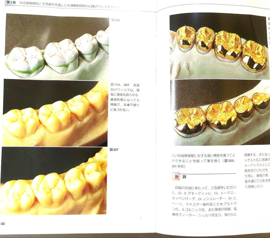 (絶版)　D.シュルツのワックスアップテクニック