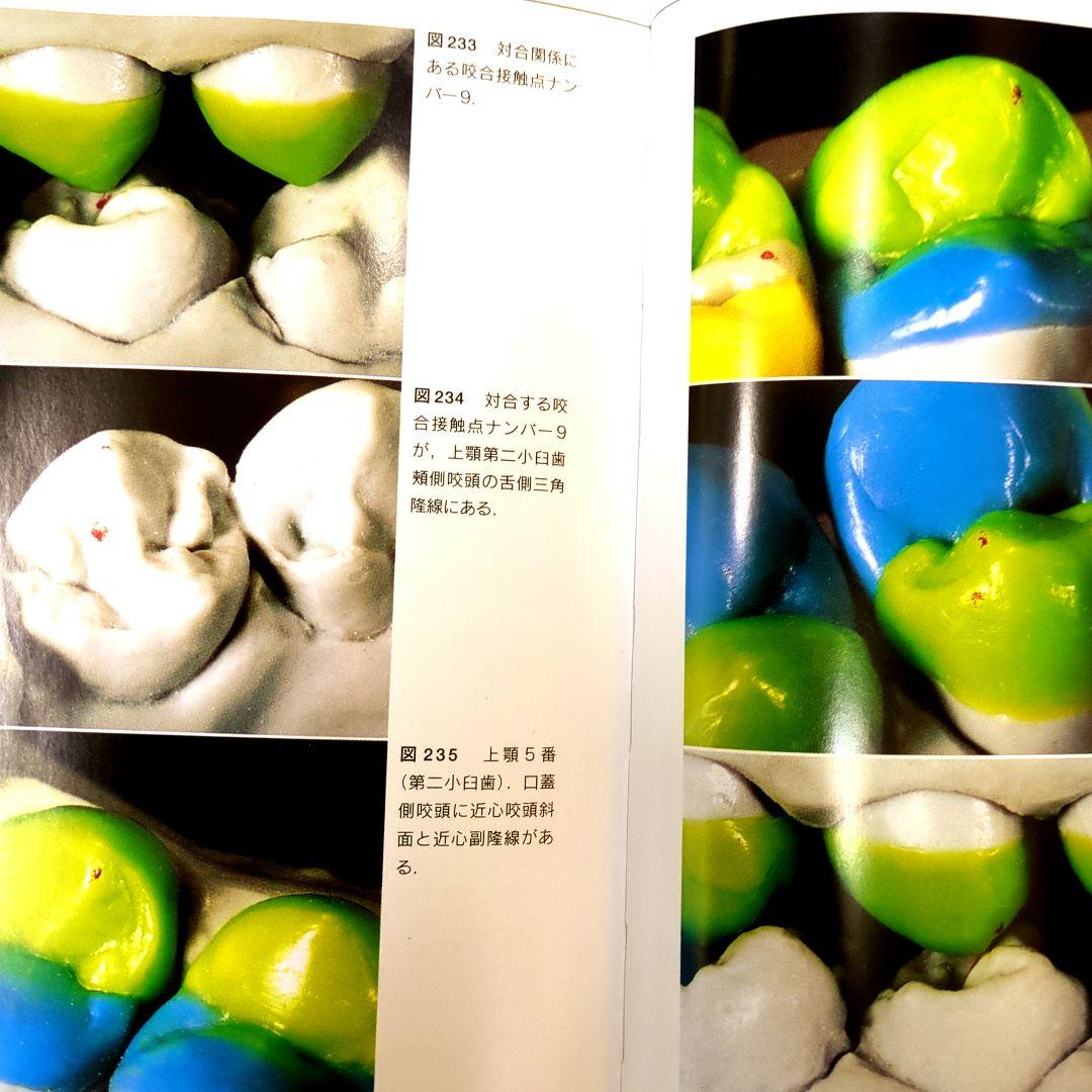 (絶版)　D.シュルツのワックスアップテクニック