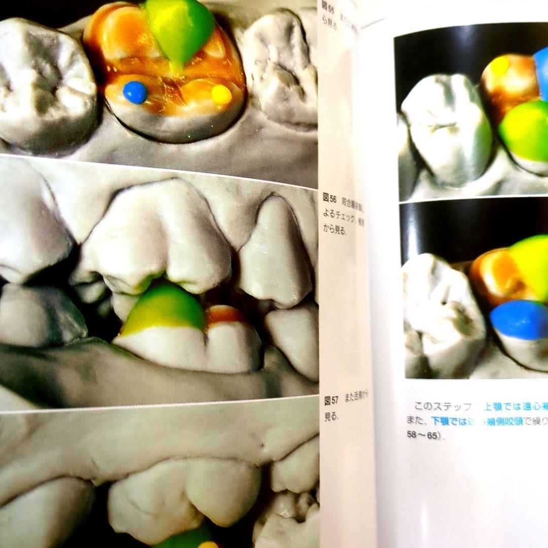 (絶版)　D.シュルツのワックスアップテクニック