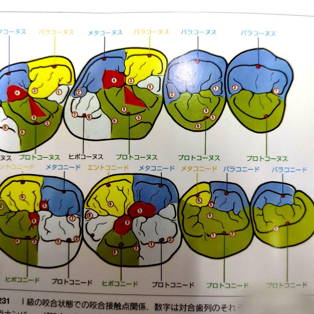 (絶版)　D.シュルツのワックスアップテクニック