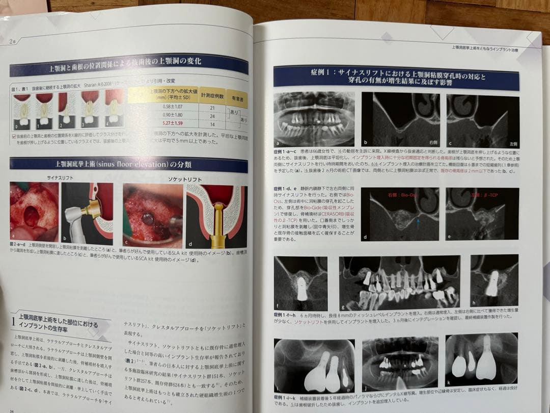 エビデンス・ベースト・インプラントロジー