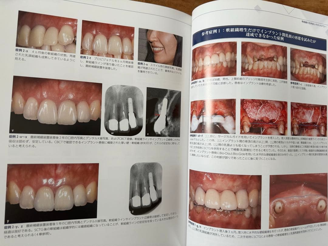 エビデンス・ベースト・インプラントロジー