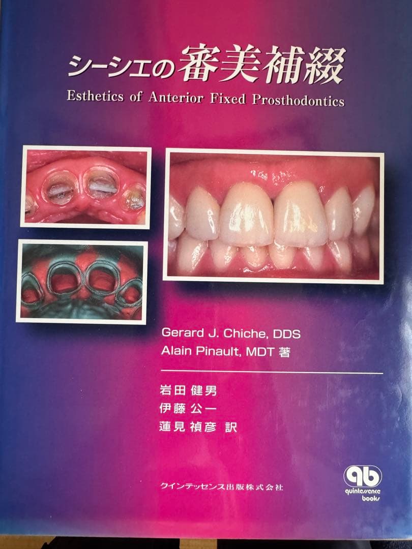 シーシェの審美補綴