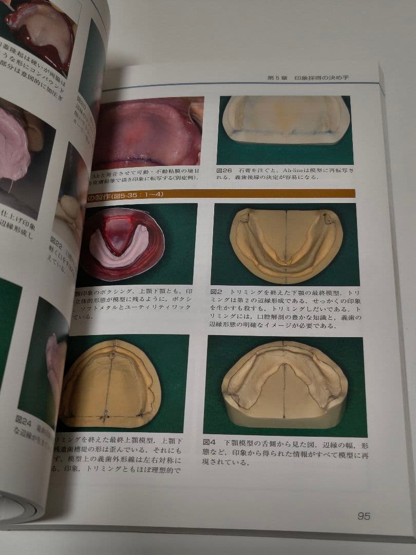 有床義歯臨床ヒント集 カラーアトラス クインテッセンス出版 歯科専門書
