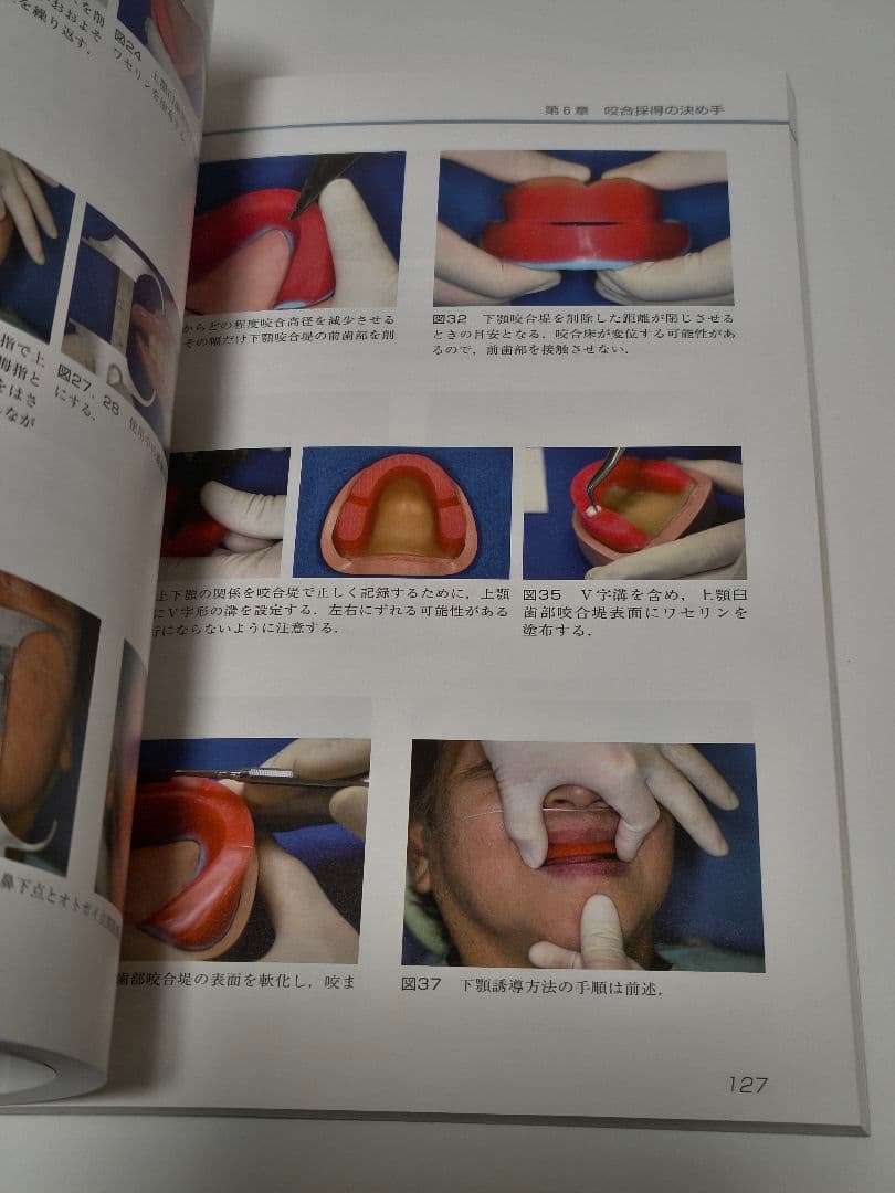 有床義歯臨床ヒント集 カラーアトラス クインテッセンス出版 歯科専門書