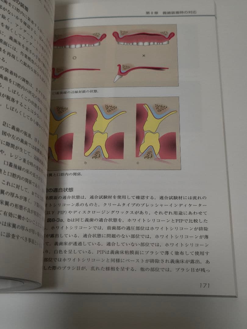 有床義歯臨床ヒント集 カラーアトラス クインテッセンス出版 歯科専門書