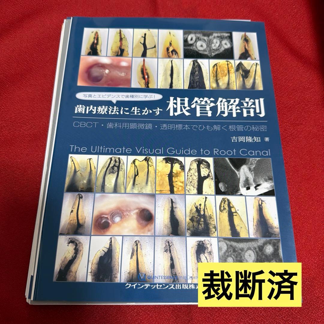 【裁断済】写真とエビデンスで歯種別に学ぶ! 歯内療法に生かす根管解剖 CBCT