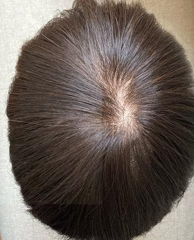 あんてる　スヴェンソン　Raycious RK31　セミオーダー　医療用