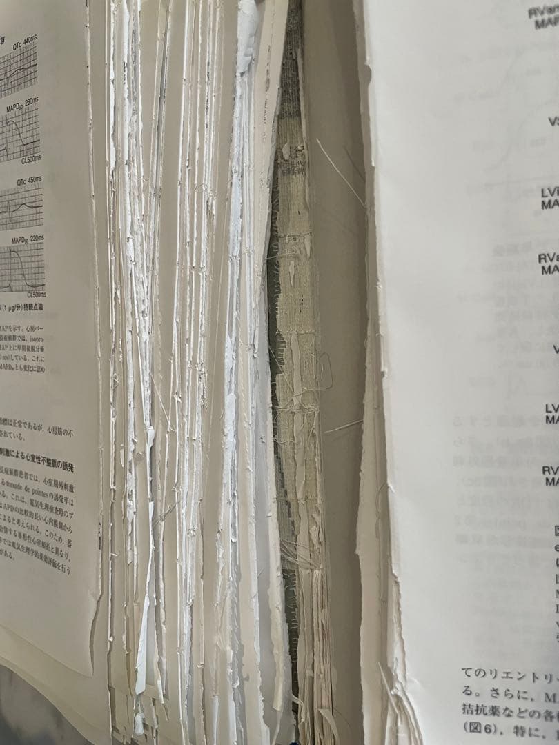 あるぱか　EPS 第2版＋カンファレンスで学ぶ 心臓電気生理のすべて