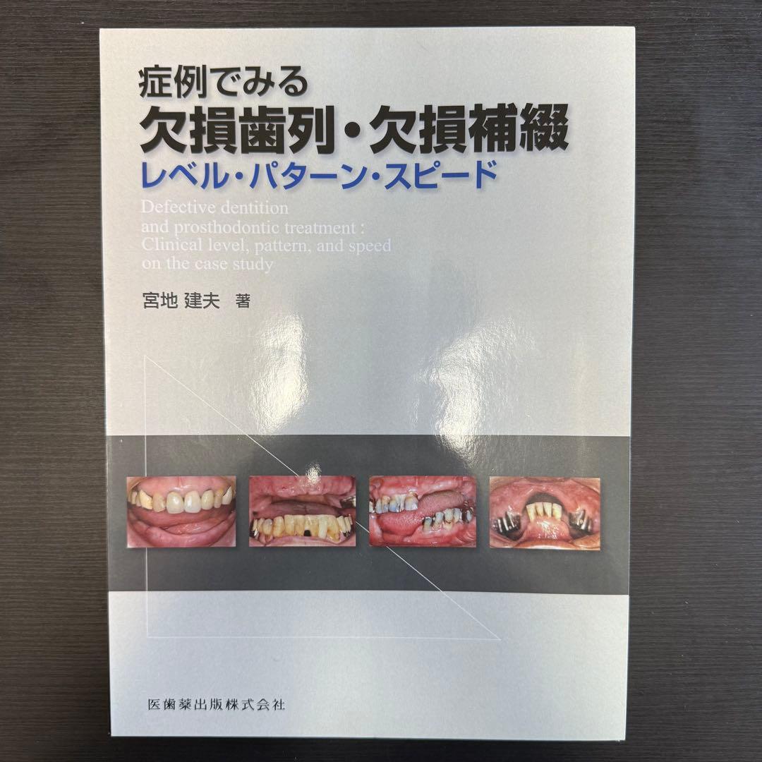 症例でみる欠損歯列・欠損補綴　レベル・パターン・スピード