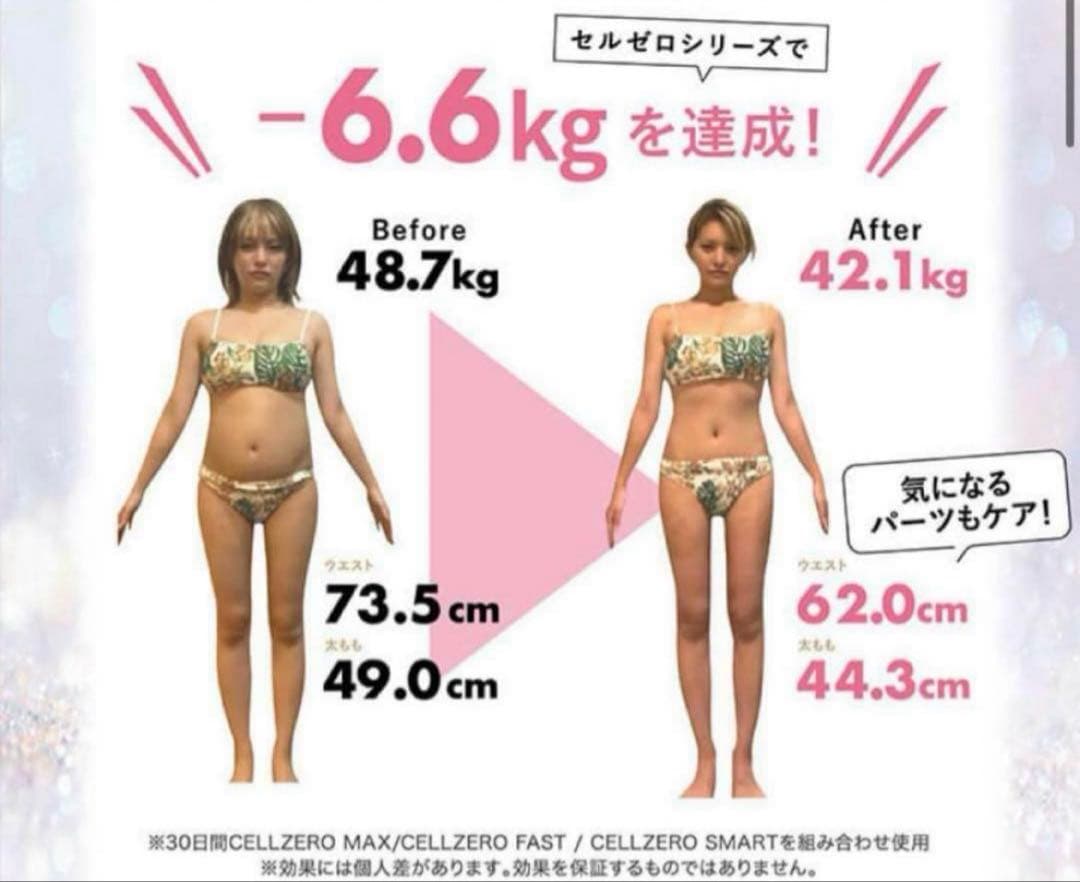 じぶんでエステ　セルゼロバッグ　フェイス ボディ用 エステマシン