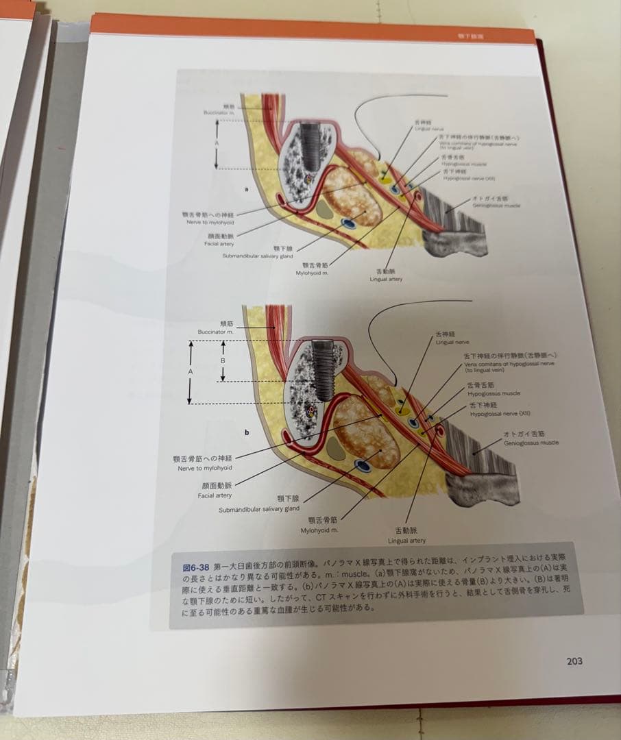 【裁断済】アナトミー 2 インプラント臨床のための解剖