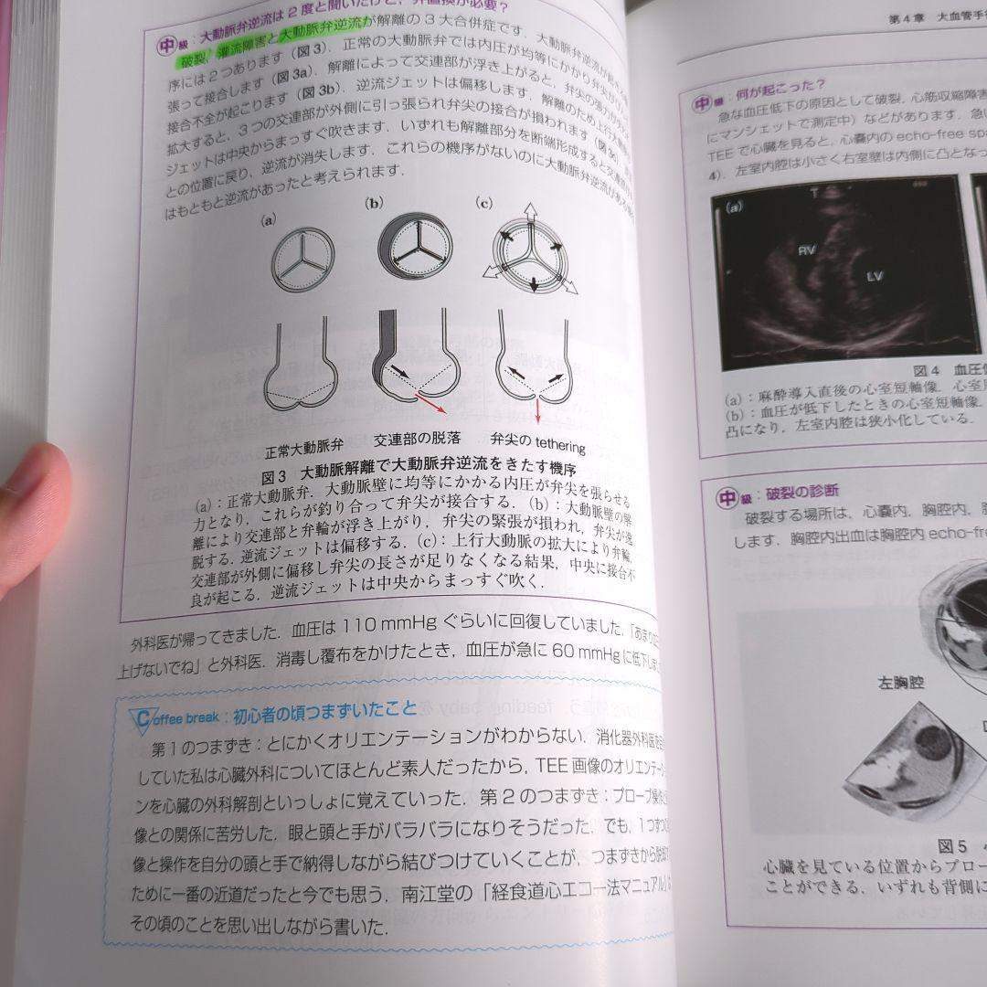 ＃未裁断＃　初心者から研修医のための経食道心エコー 部長も科長もみんな初心者