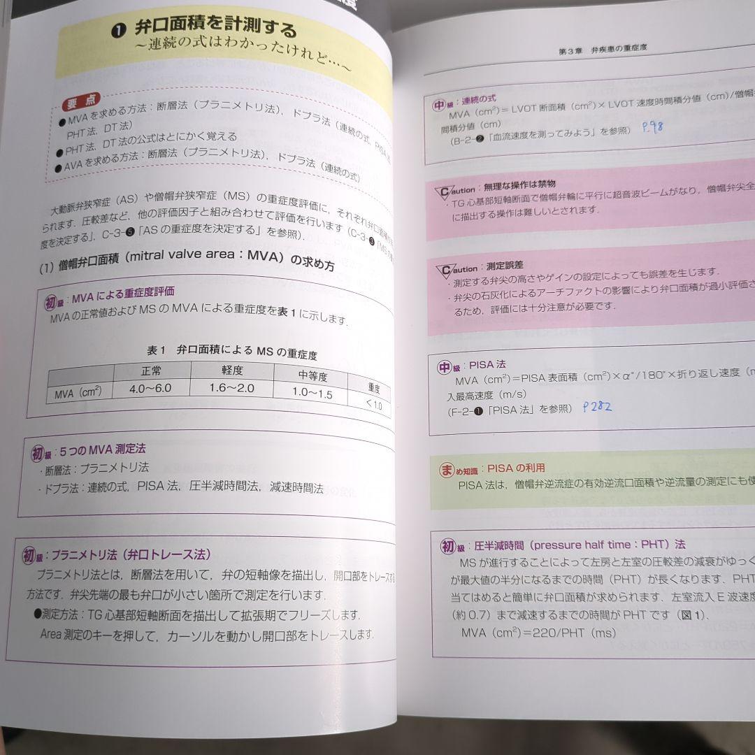 ＃未裁断＃　初心者から研修医のための経食道心エコー 部長も科長もみんな初心者