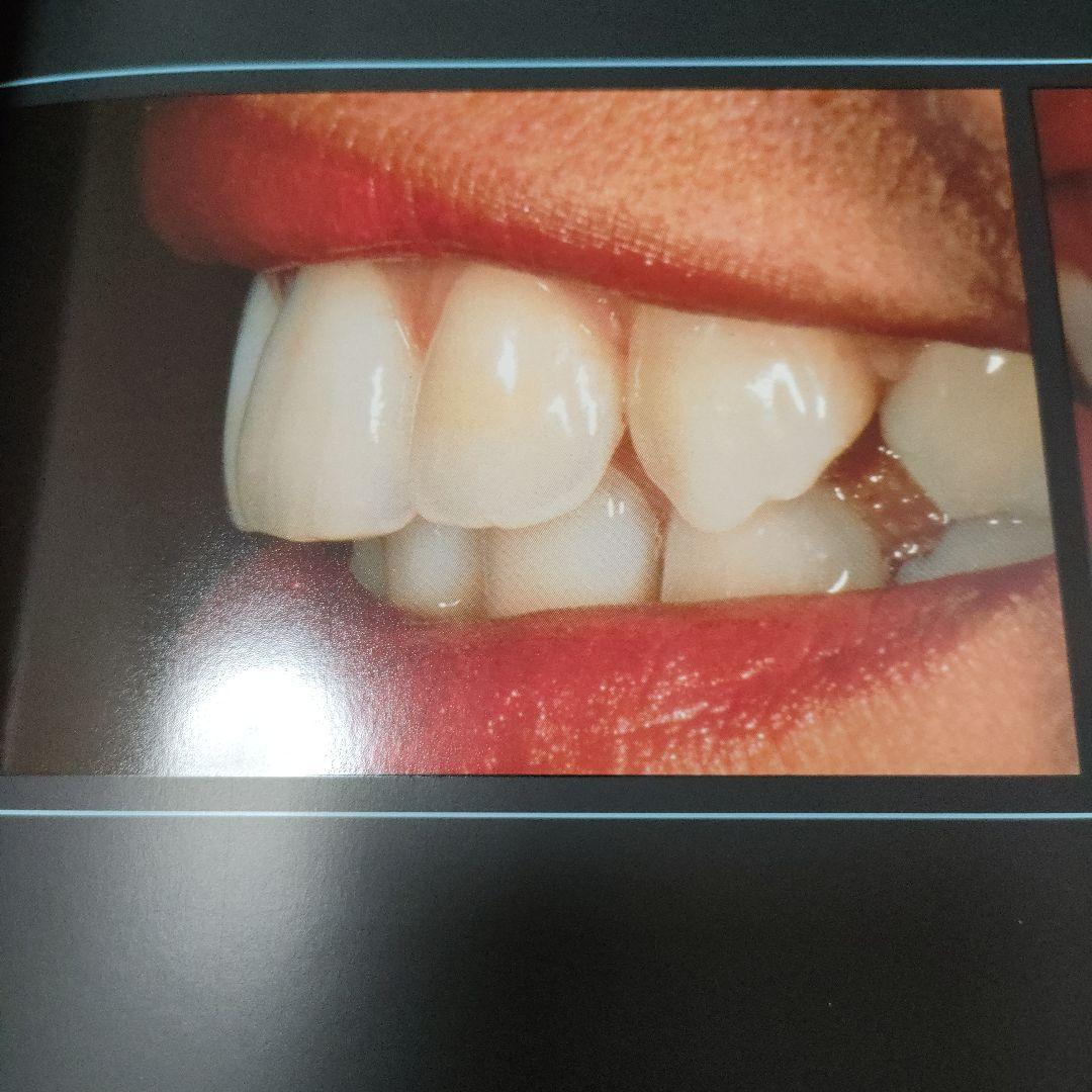 セラミックスの極致 CLAUDE SIEBER著　歯科技工　ポーセレン　写真集