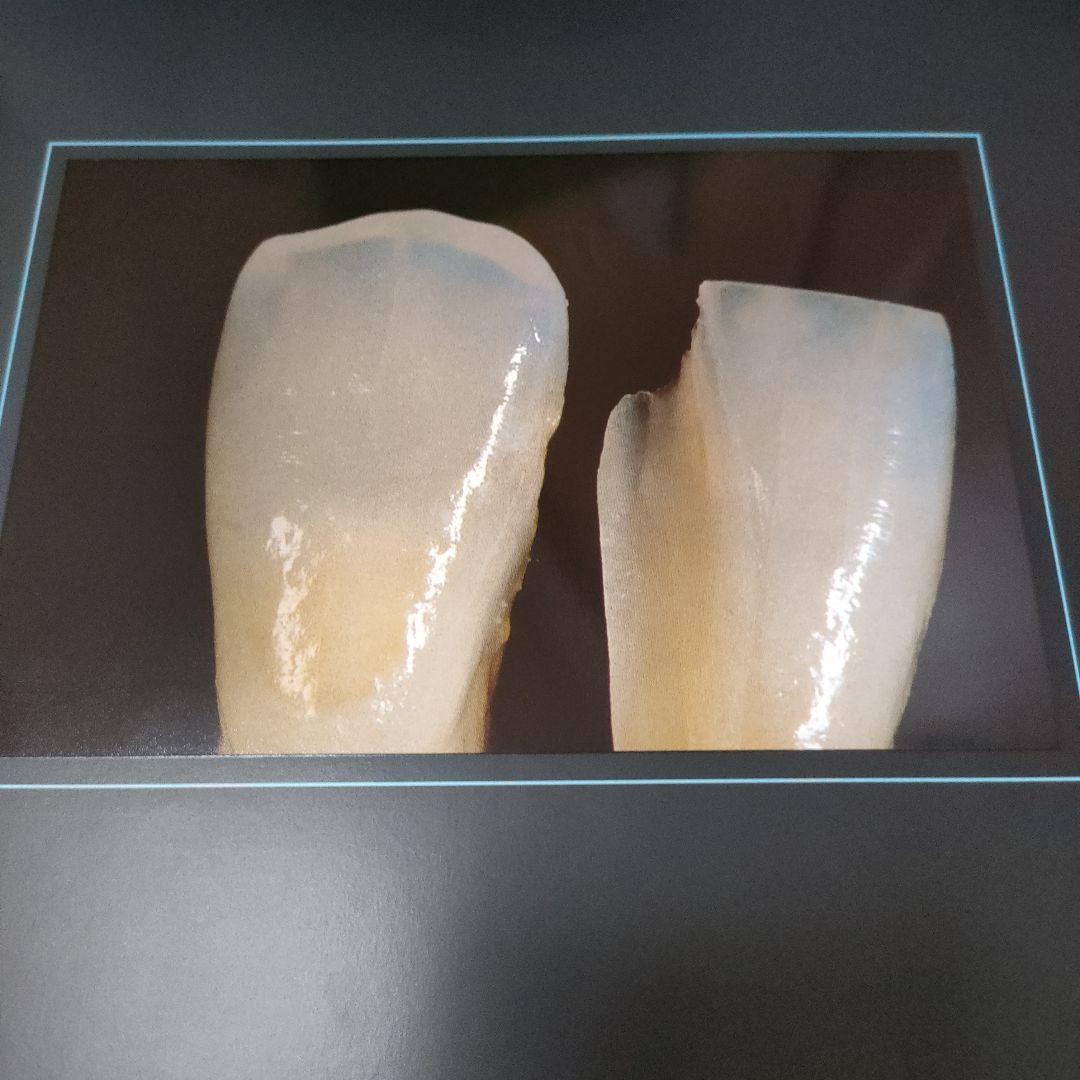 セラミックスの極致 CLAUDE SIEBER著　歯科技工　ポーセレン　写真集