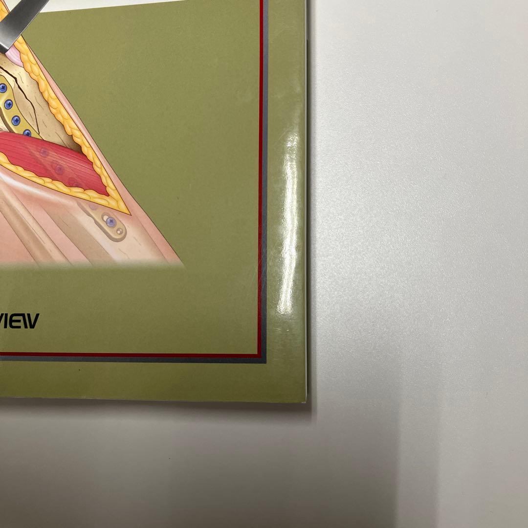 骨折　プレート治療マイスター　第2版