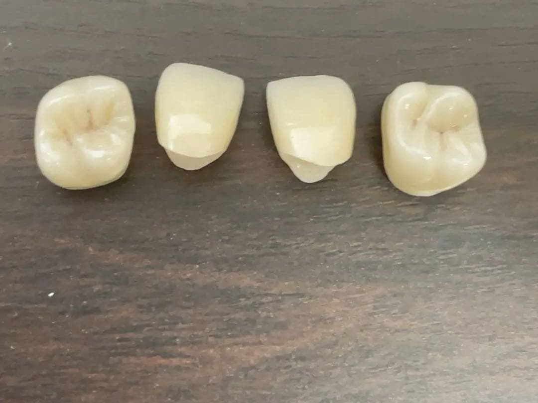 歯科技工　ジルコニアクラウン　フルマウス　ダブルスキャンで製作