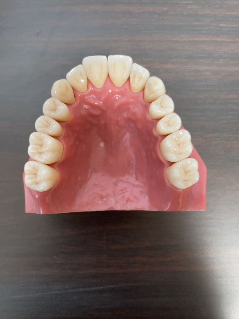 歯科技工　ジルコニアクラウン　フルマウス　ダブルスキャンで製作