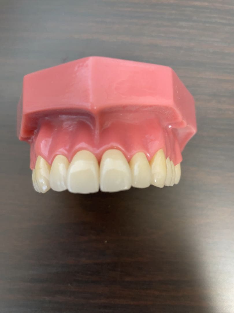 歯科技工　ジルコニアクラウン　フルマウス　ダブルスキャンで製作