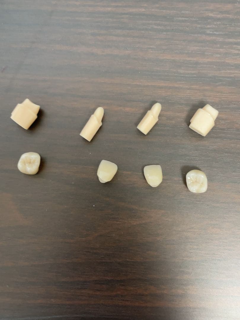 歯科技工　ジルコニアクラウン　フルマウス　ダブルスキャンで製作