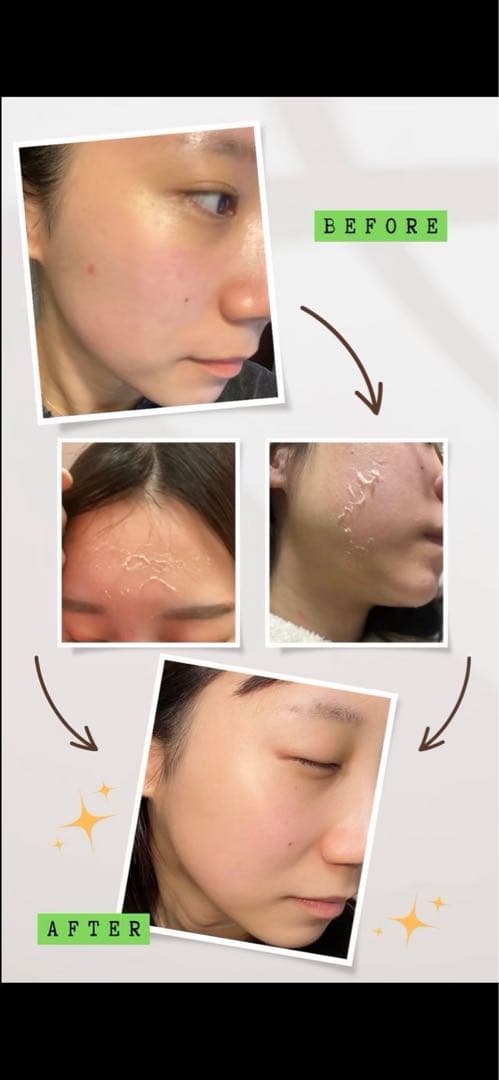 美ラボさん専用　剥離ありハーブピーリング50回分