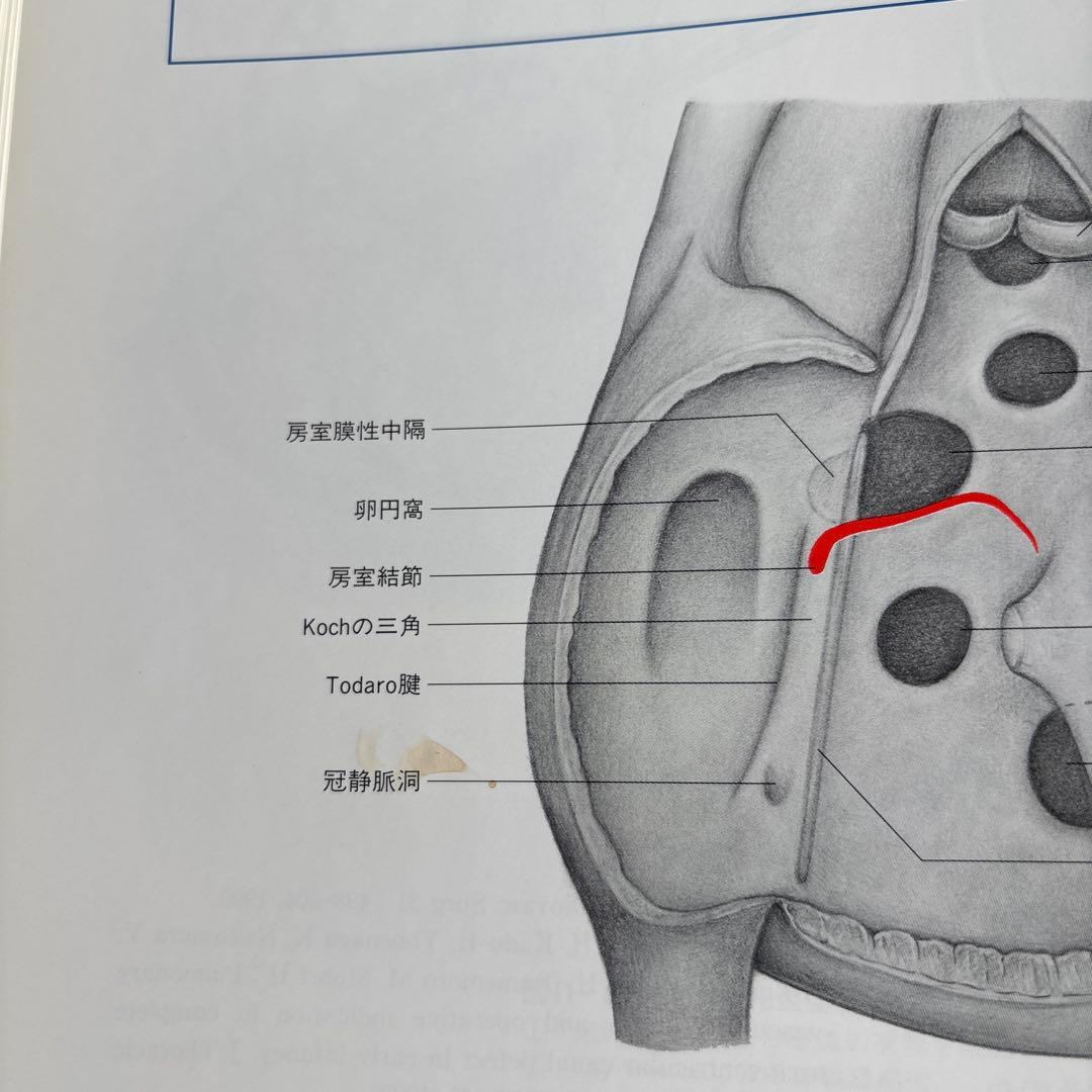 先天性心疾患手術書　安井久喬 / 角秀秋 / 益田宗孝
